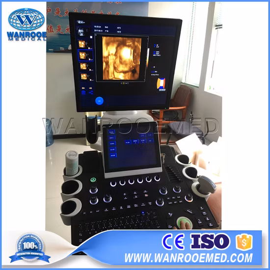 Usc900 carrinho médico 4D sistema de diagnóstico ultrassônico scanner de ultrassom Doppler colorido