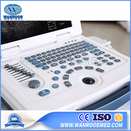 Varredor ultrassônico portátil do ultrassom do equipamento do diagnóstico de Digitas